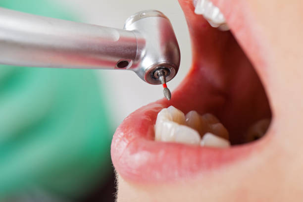 Best Emergency Gum Treatment in Iyanbito, NM